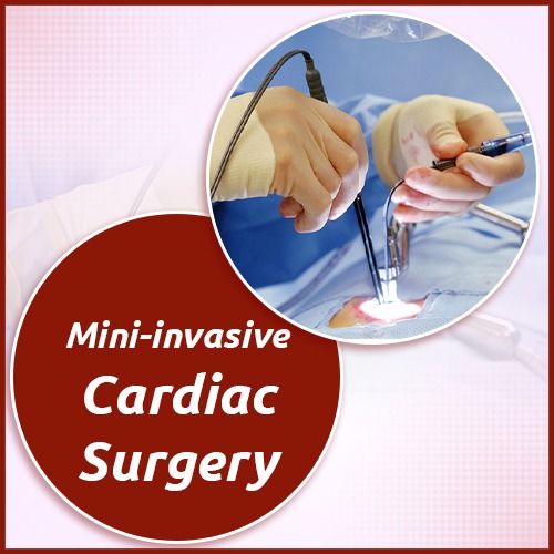 Mini-invasive Cardiac Surgery : Dr. Ashish Dolas